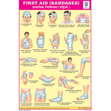 Bandages Chart Paper (24 x 36 CMS)